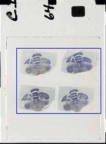 Media type: image; Special Collections 3298   shows specimen_part histological serial section;